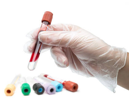 איזה בדיקות דם חשוב לבקש מרופא המשפחה | אקוסאפ - ויטמינים